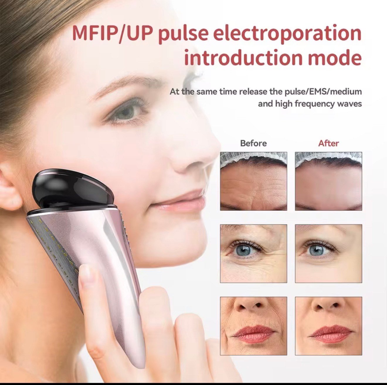 Pulse Radio Frequency Beauty Instrument | Skin Rejuvenation & Firming - Image 7