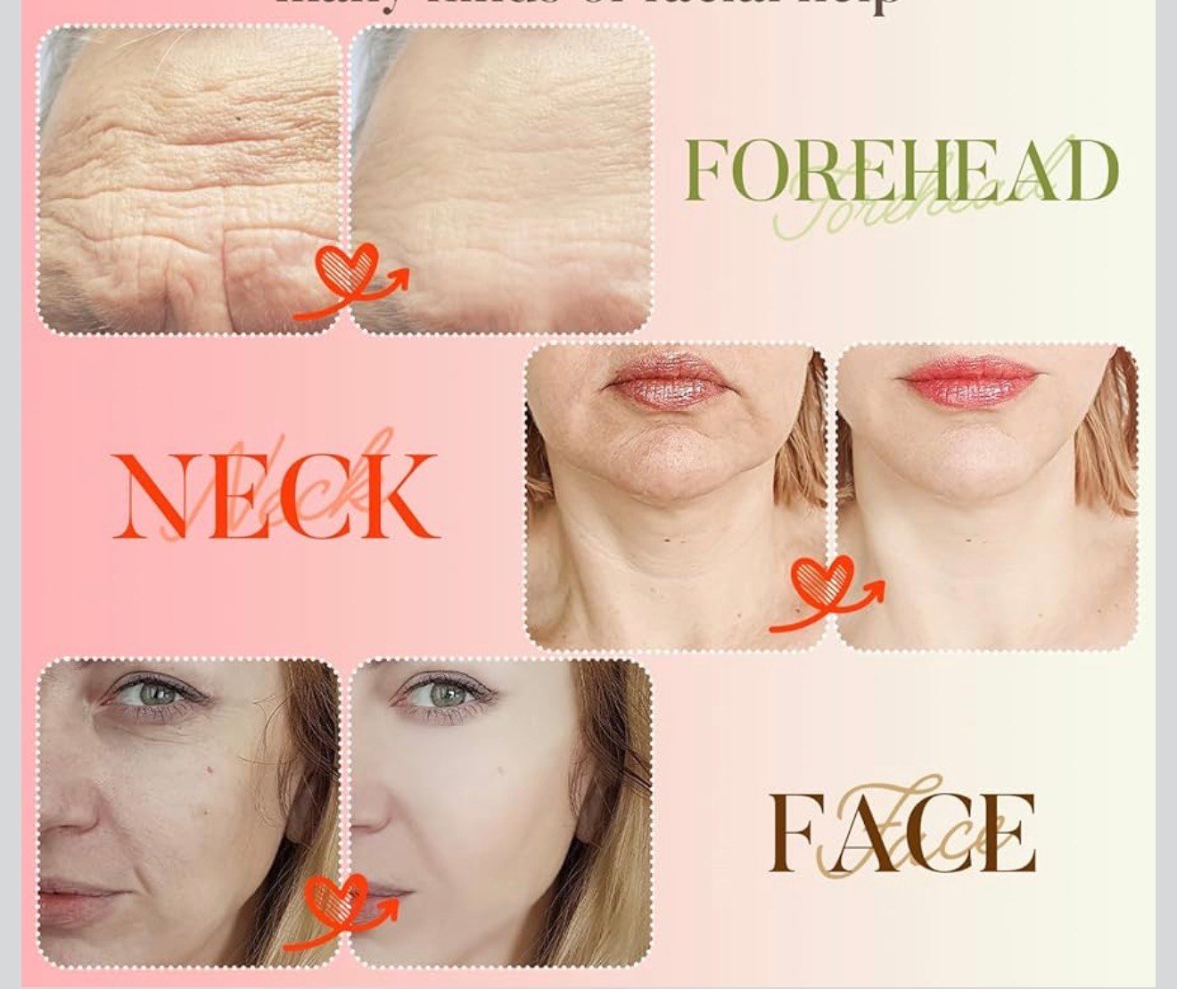 Beautiora Electric Skin Rejuvenation Beauty Instrument – Pore Cleaner - Image 7