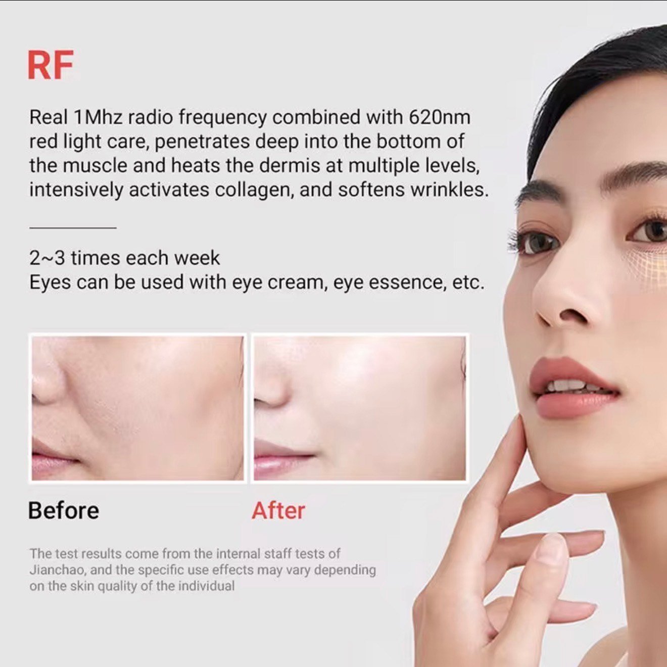 RF & EMS Skin Renewal Device - Image 5