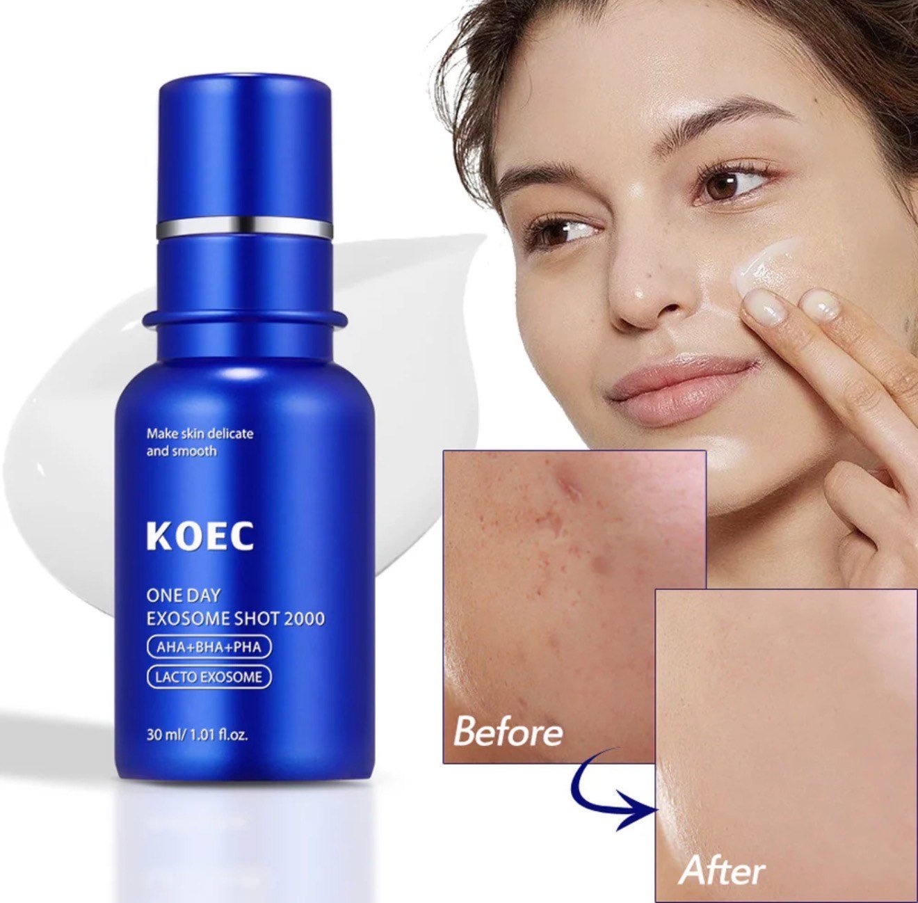 KOEC One Day Exosome Shot 2000 – Intensive Pore Tightening & Skin Renewal Serum with AHA, BHA, PHA - Image 7