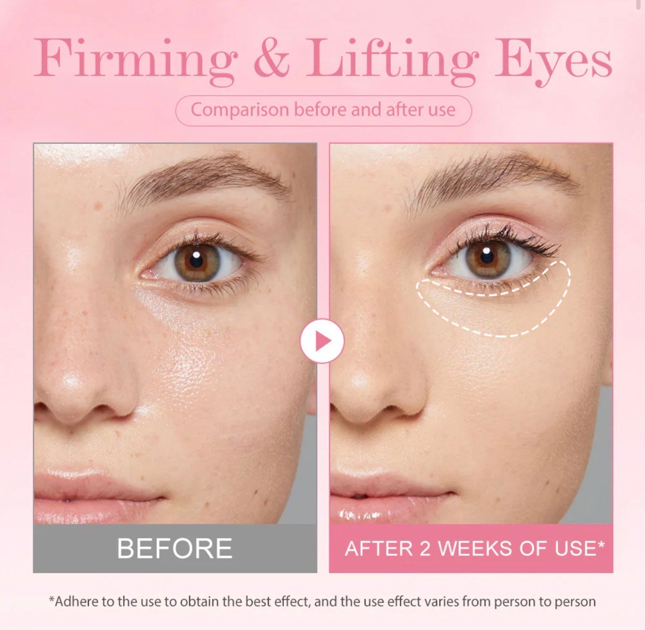 Niacinamide Retinol Eye Cream for Under-Eye Dark Circles