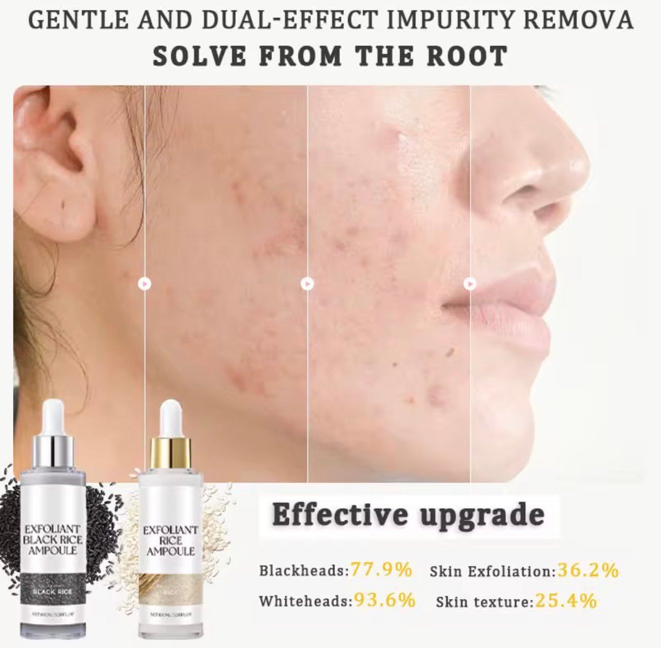 KOEC Exfoliant Rice & Black Rice Ampoule Duo – Radiance & Texture Repair (100 mL each) - Image 8